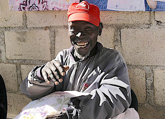 モザンビーク・75歳男性